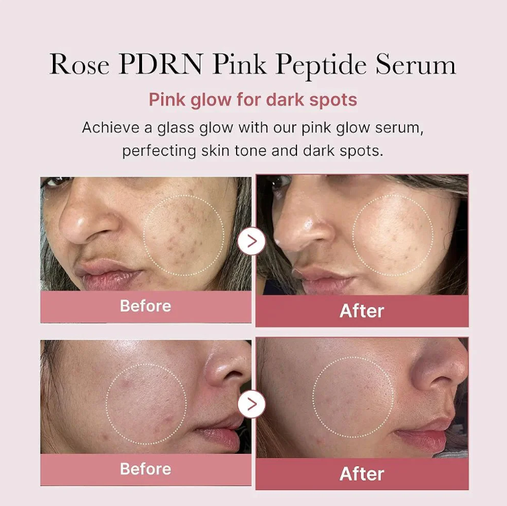 Medicube PDRN pdrn Pink Peptide Serum 30ml